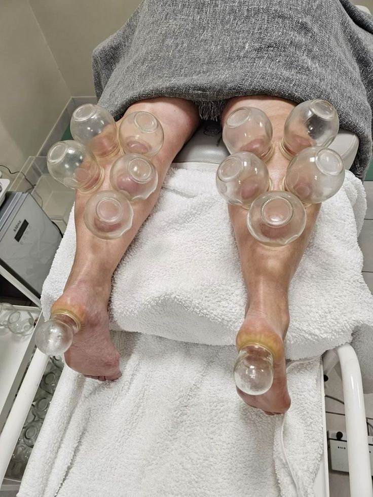 Reflexology Image